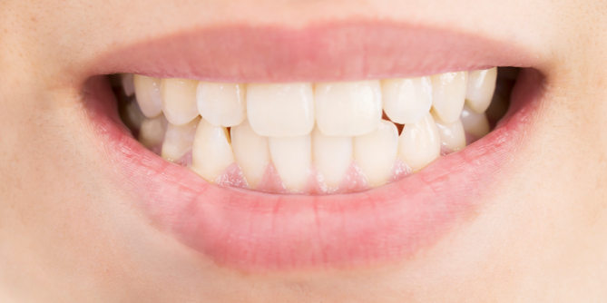 口元の写真 シミュレーション後